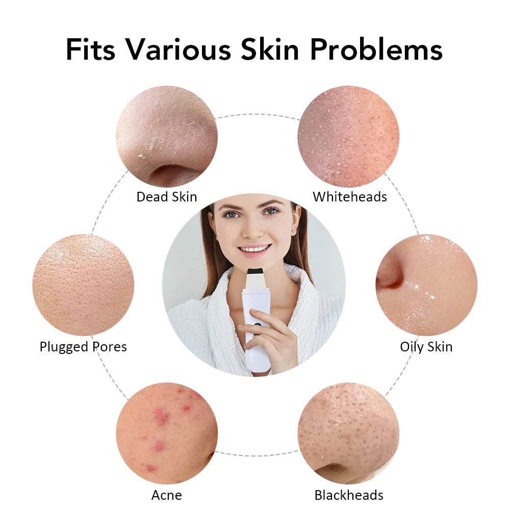 Ultrasonic Skin Scrubber Device