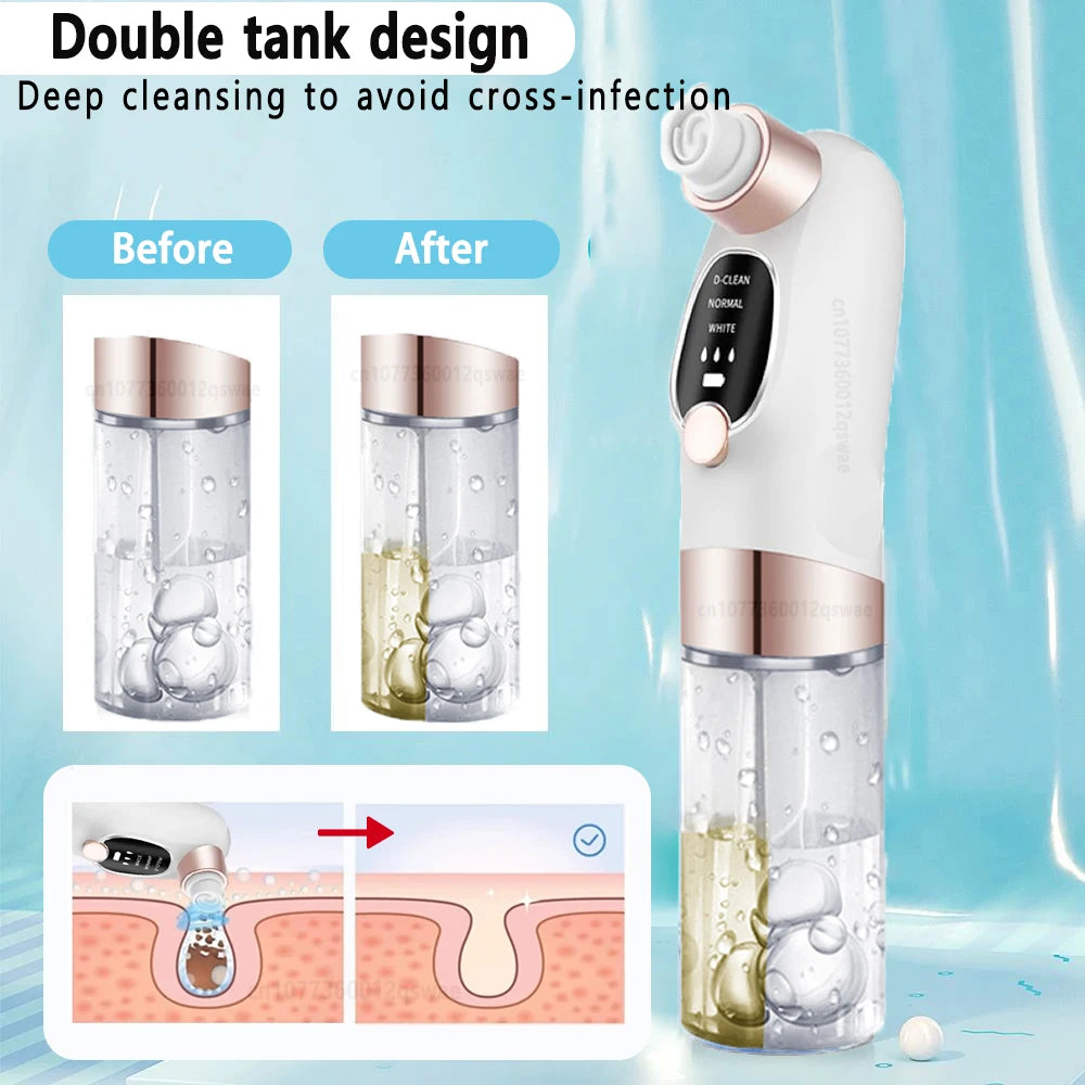 Electric Blackhead Remover Vacuum