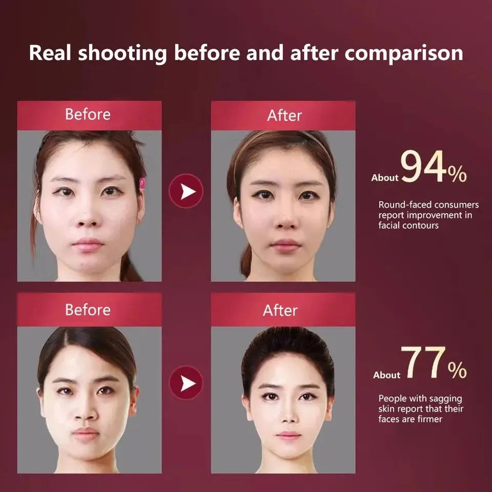 LED Photon Facial Massage Device