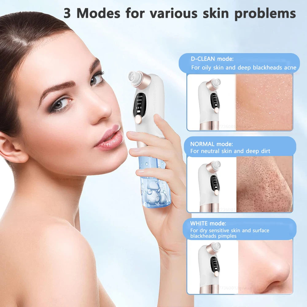 Electric Blackhead Remover Vacuum