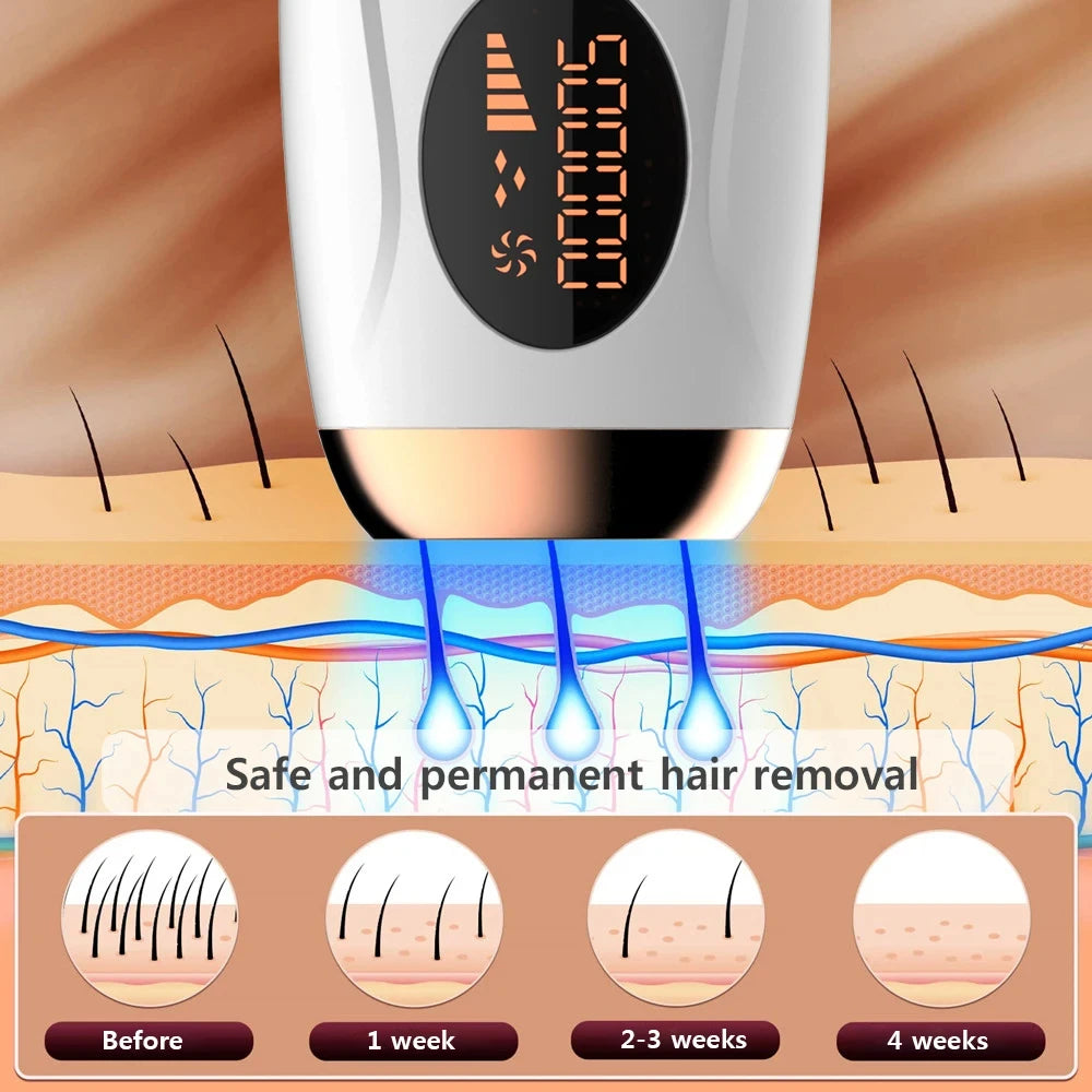 IPL Laser Hair Removal Device 990000 Flashes