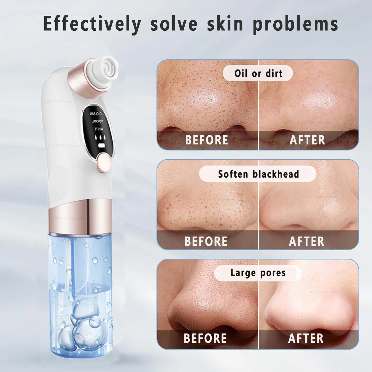 Electric Blackhead Remover Vacuum