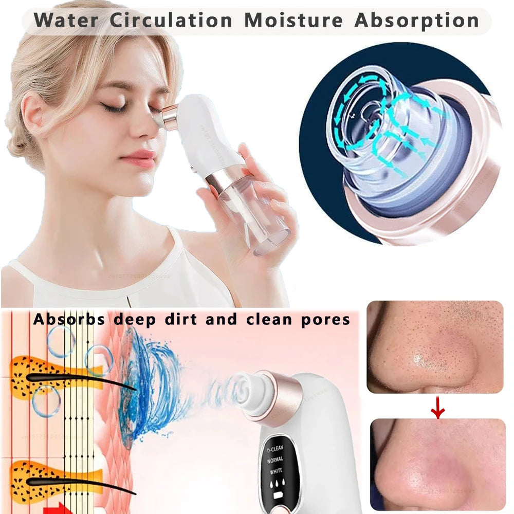 Electric Blackhead Remover Vacuum